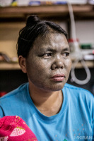 Women Of Chin, Refugee with Face Tattoo